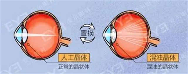 人工4.jpg