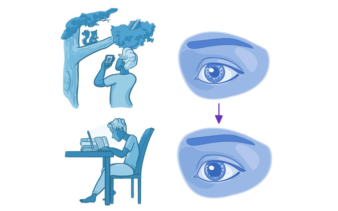 眼睛24.jpg