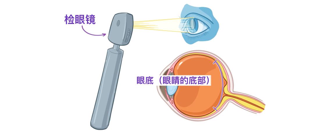 眼睛14.jpg