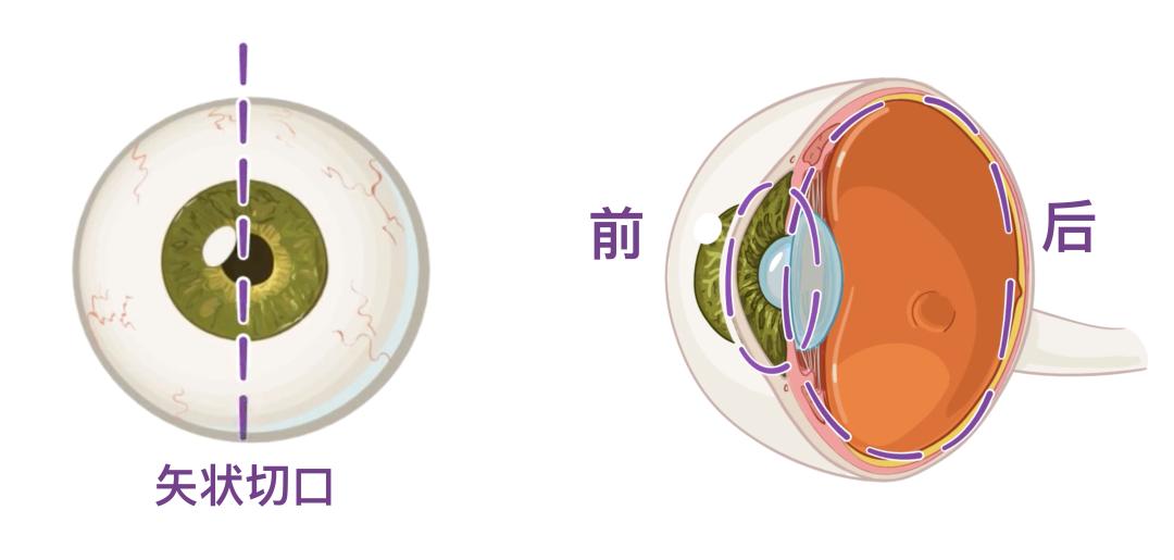眼睛3.jpg